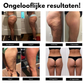 Anti-Cellulite Shaping Leggings - 1+1 Gratis