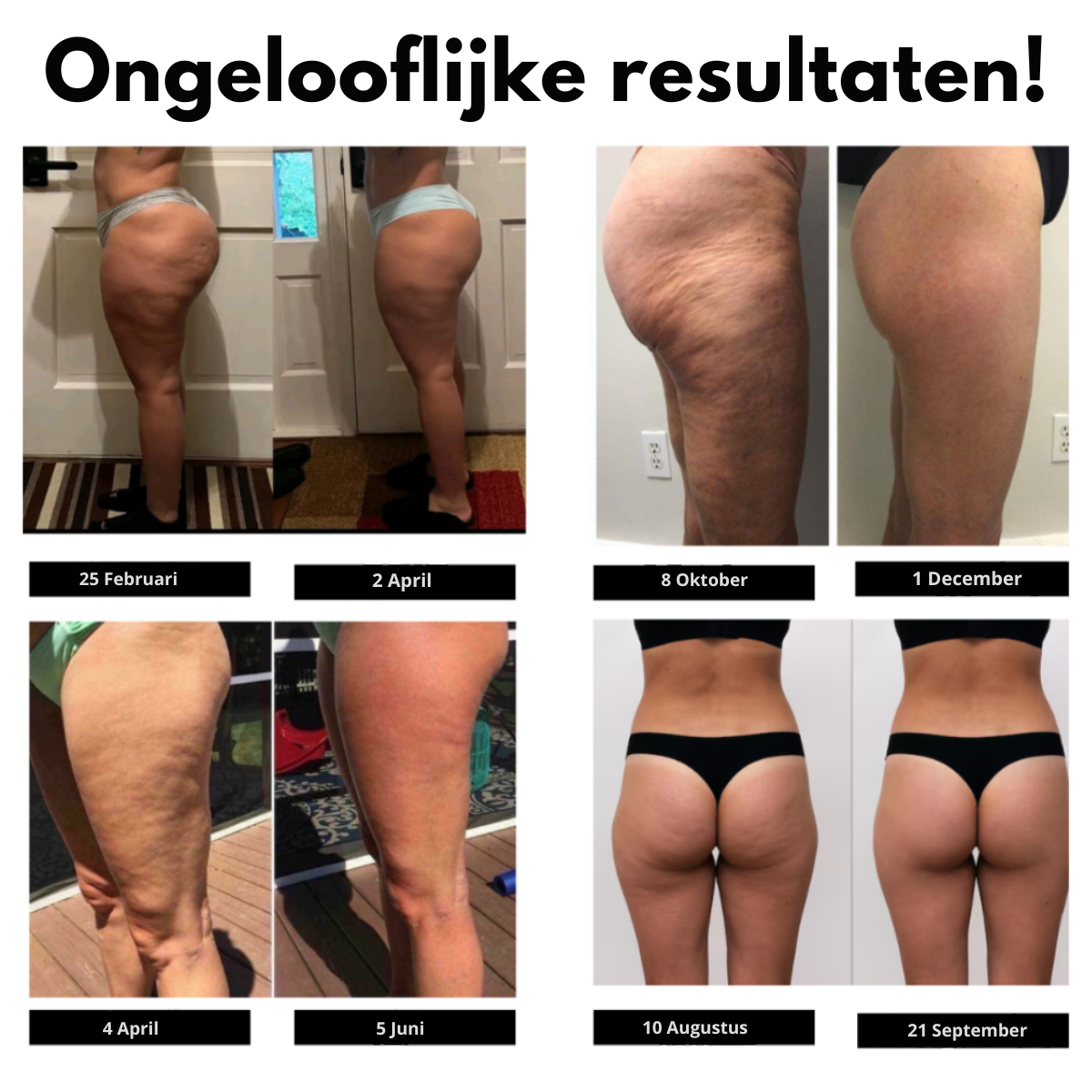 Anti-Cellulite Shaping Leggings - 1+1 Gratis